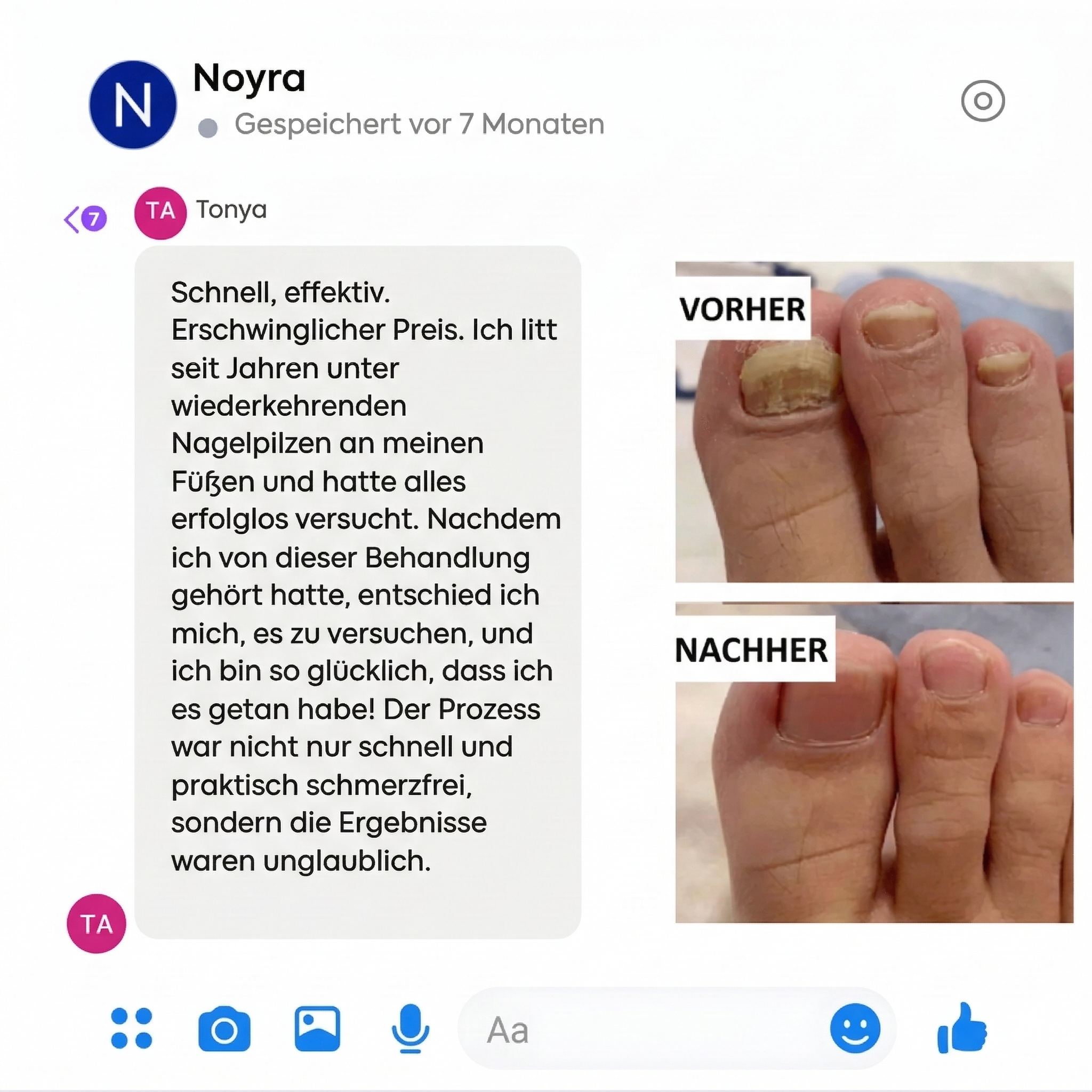 Noyra Facebook ad: Endlich frei von Nagelpilz.