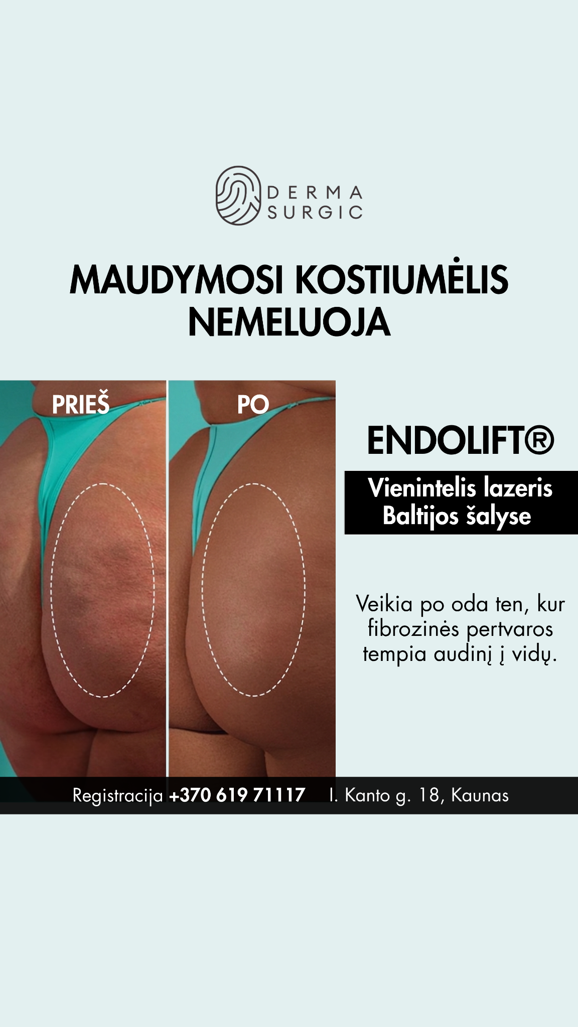 DermaSurgic estetinės medicinos ir chirurgijos centras Facebook ad