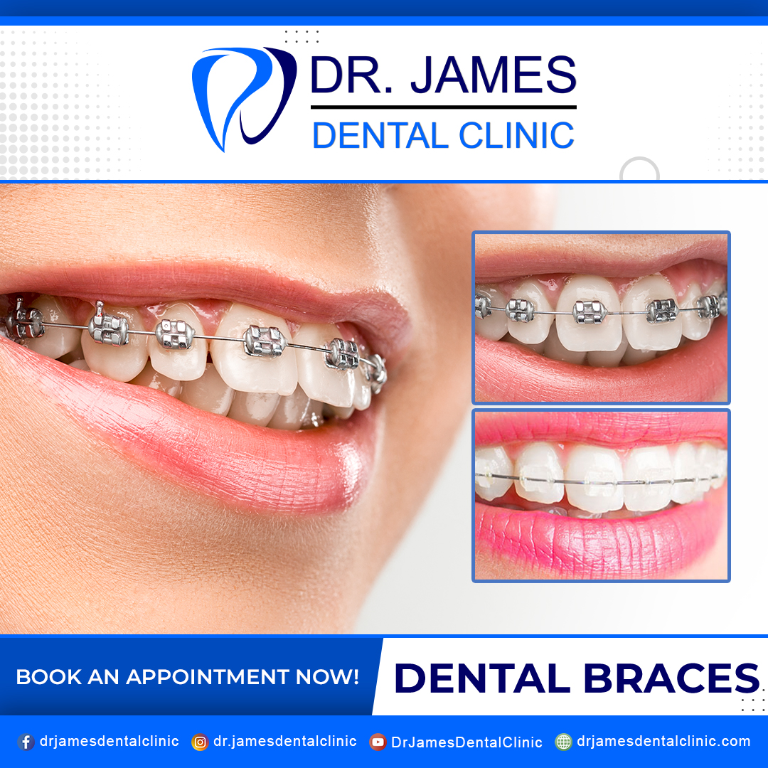 Dr. James Dental Clinic Facebook ad