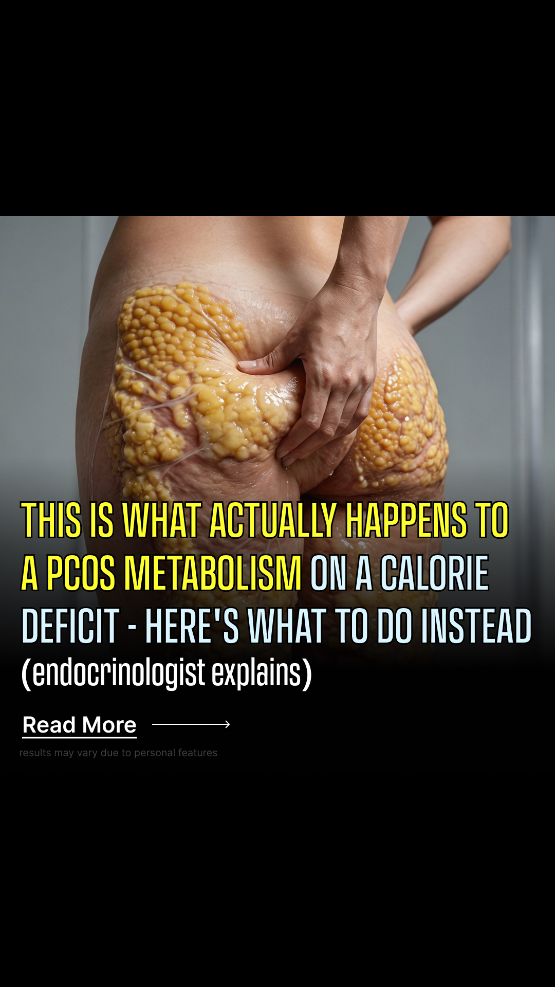 MyBody for PCOS Facebook ad