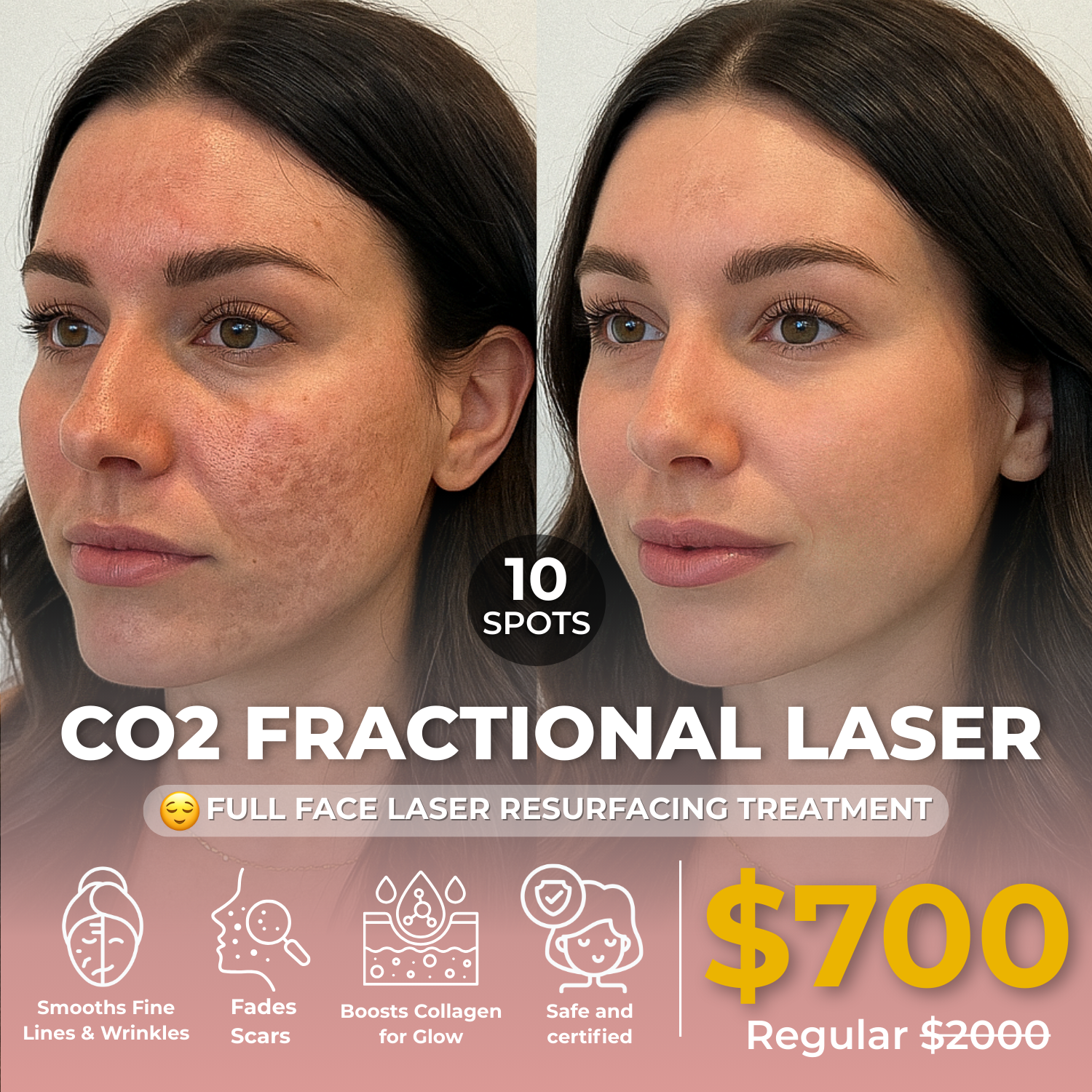 VIVA Aesthetics & Wellness Facebook ad: Clearer, Healthier, Smoother Skin
