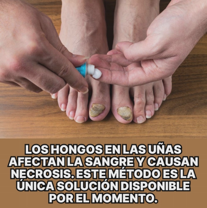 Hongos Facebook ad: Lo principal para hoy.