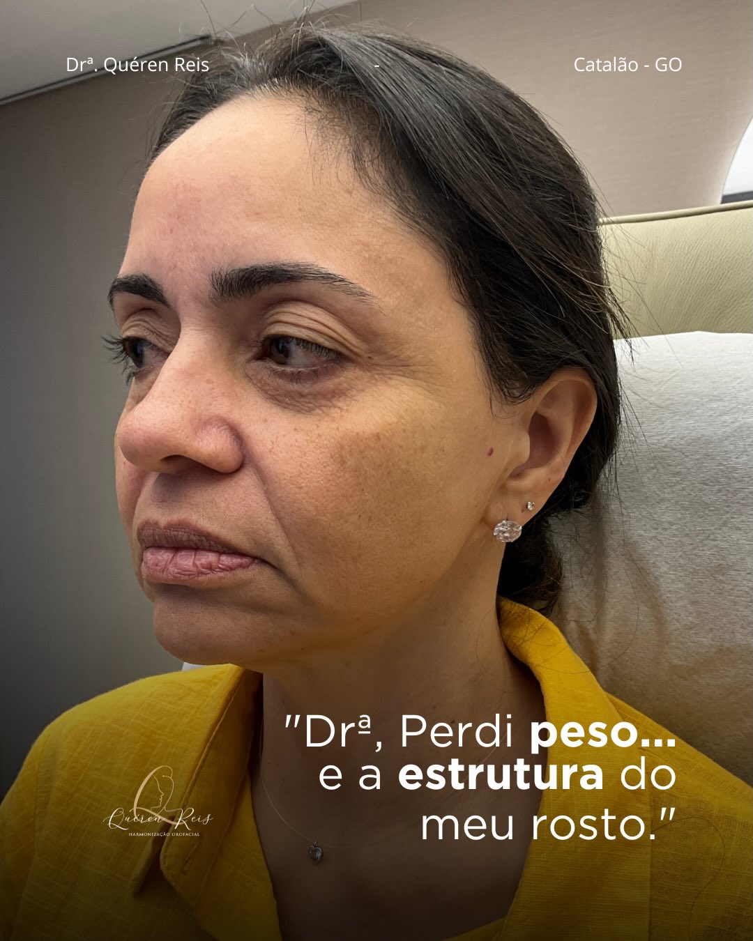 Dra. Quéren Reis Facebook ad: Drª, perdi peso.