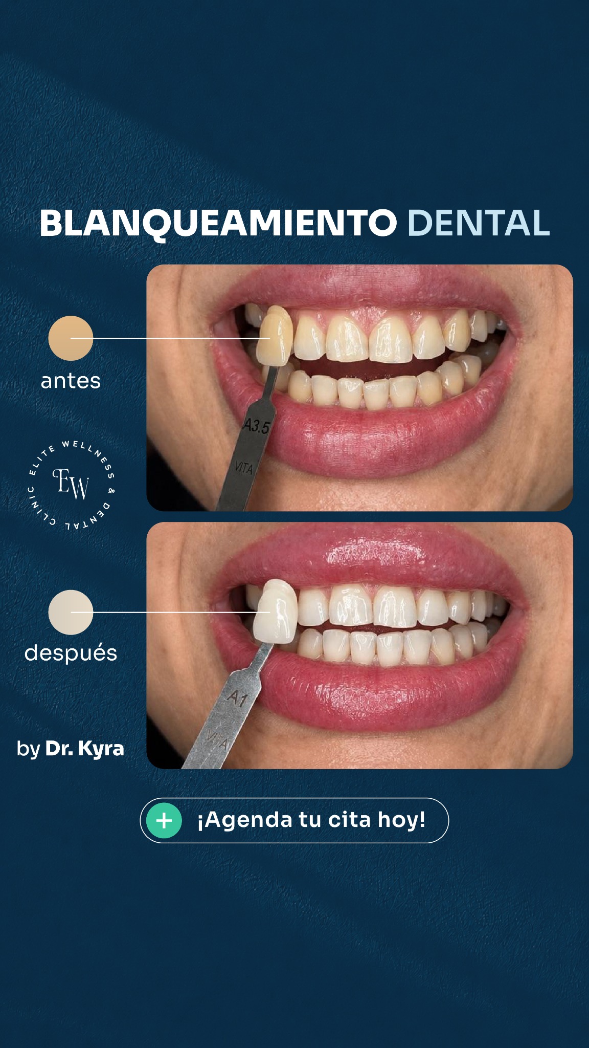 Elite Wellness and Dental Clinic Facebook ad from Aug 14, 2026