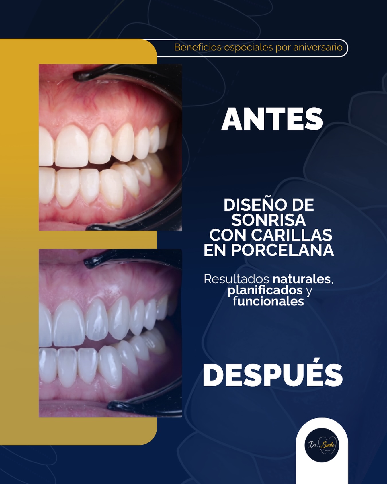 Dr. Smile Colombia Facebook ad