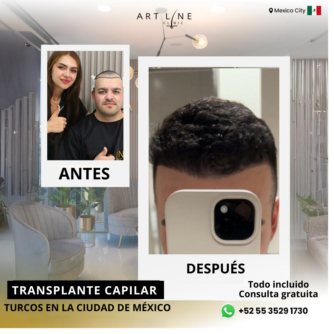 Art Line Hair Clinic CDMX Facebook ad: Agenda tu valoración