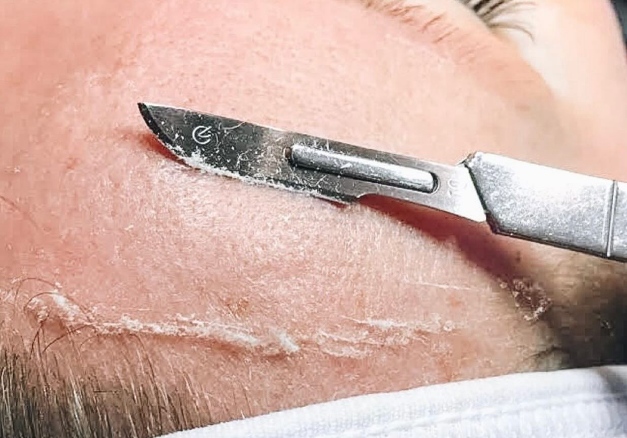 AlyssaWiens Laser & Aesthetics Facebook ad