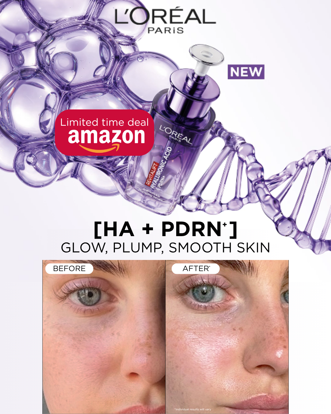 L'Oréal Paris Facebook ad