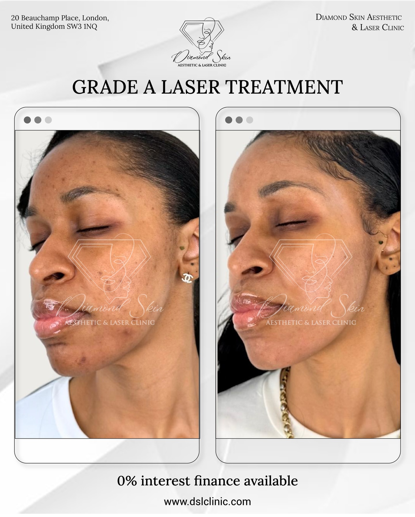 D S LASER Skin Clinic Facebook ad: Struggling with dark spots, uneven skin tone, or…