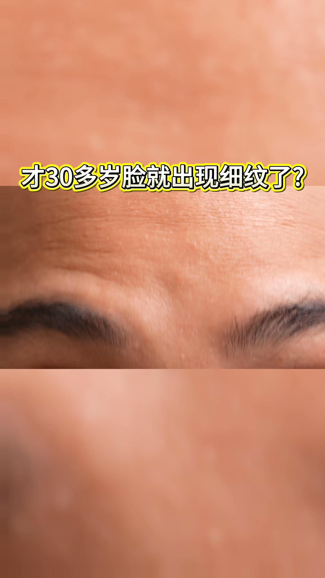 V Medical Clinic Malaysia Facebook ad: RM128 New Launch Promo | Fotona 4D Facelift by Doctor