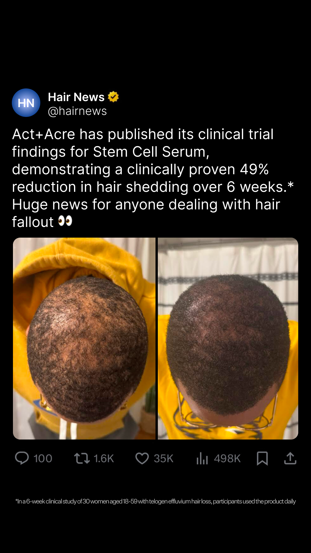ActandAcre Facebook ad