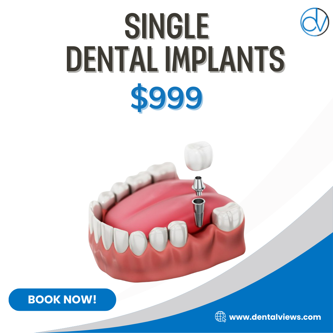 Dental Views Facebook ad