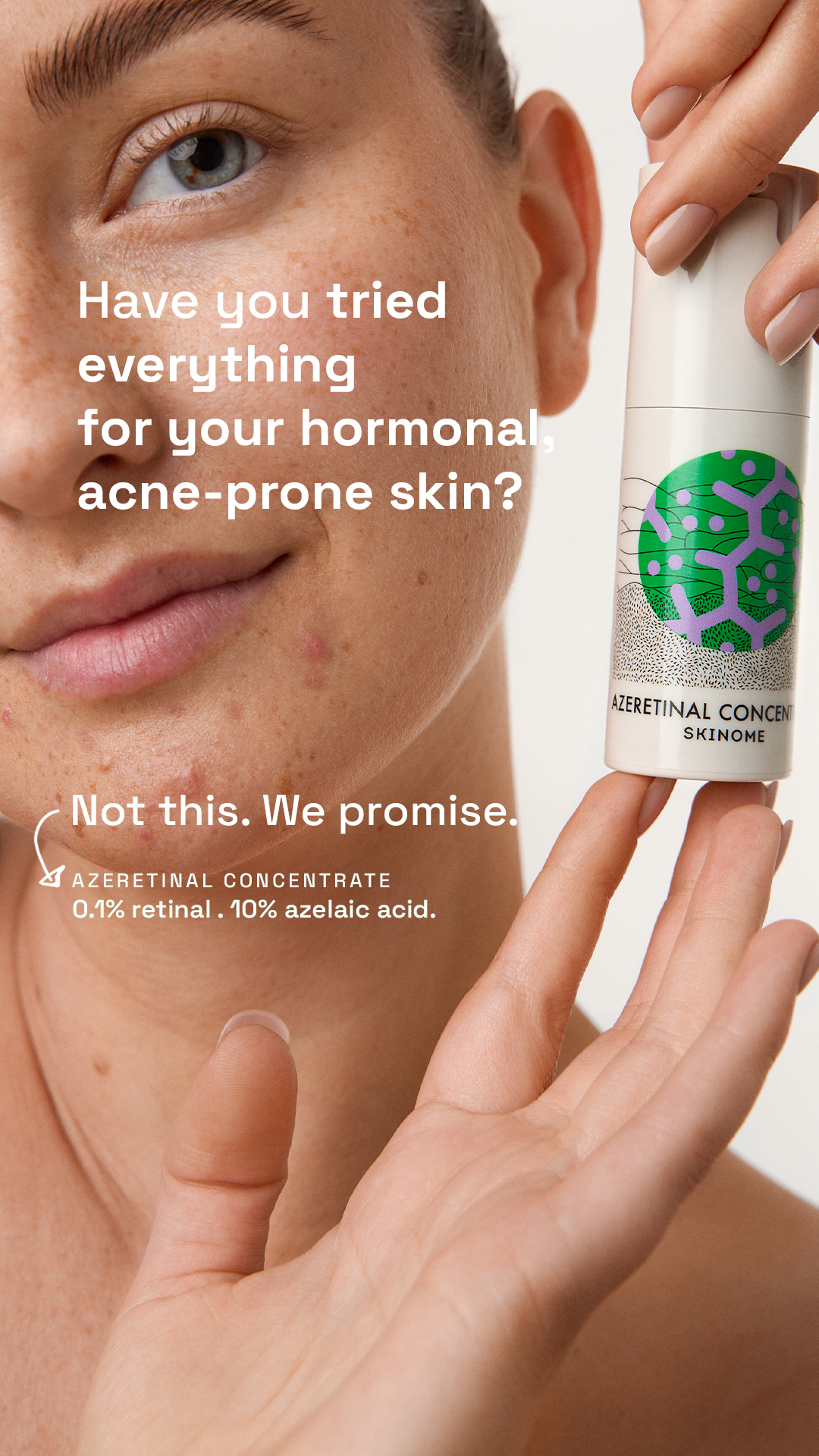 Skinome Facebook ad