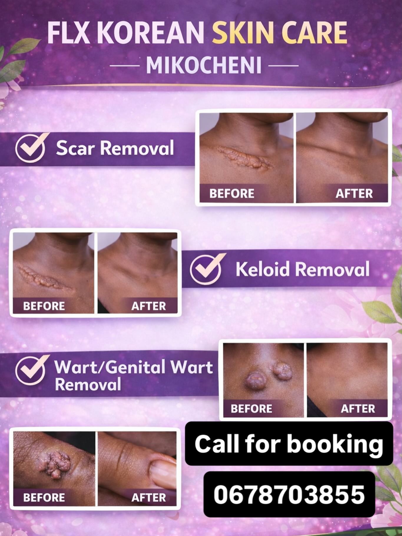 FLX Korean SkinClinic Facebook ad: FLX KOREAN SKIN CARE, MIKOCHENI