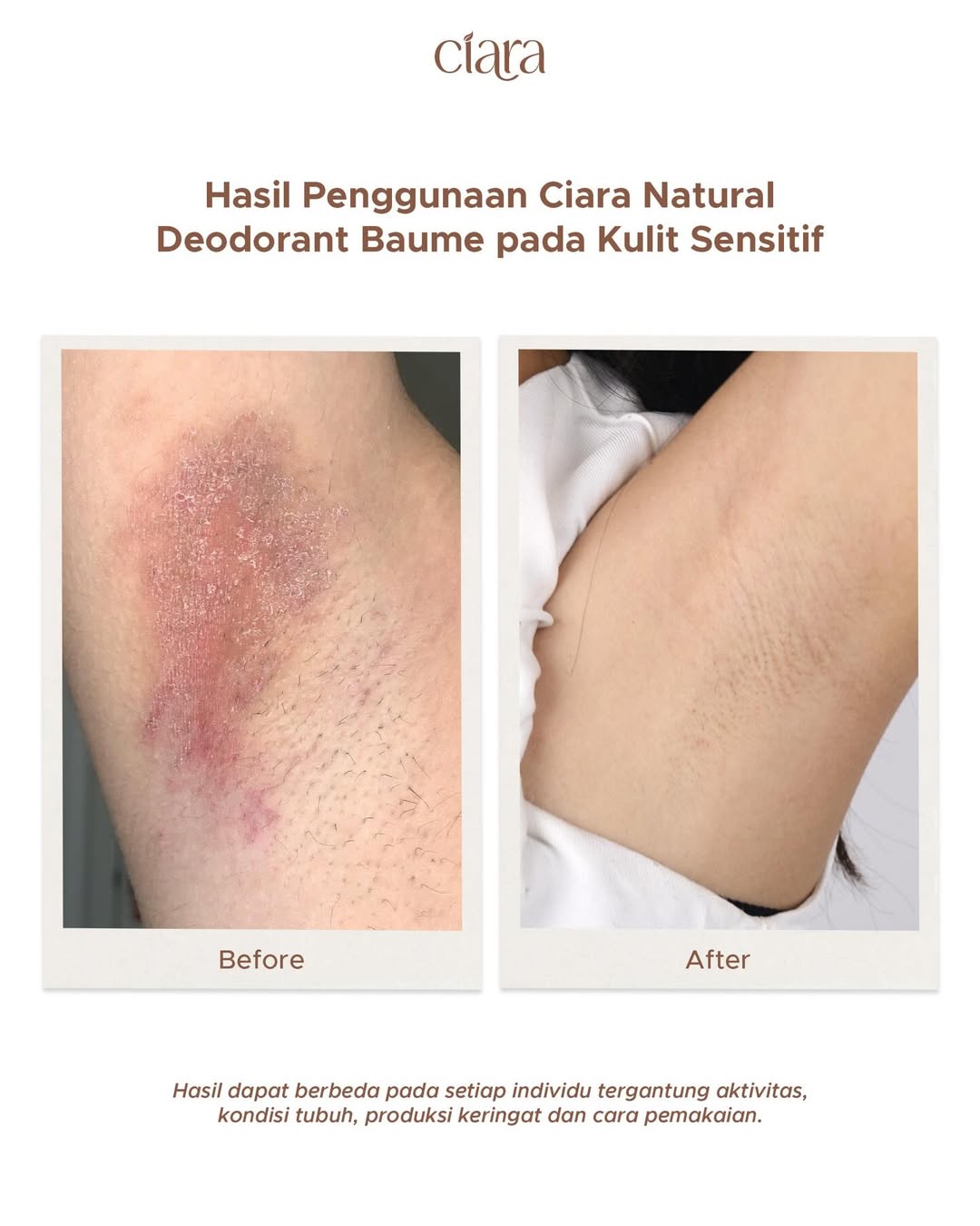 CiaraOfficial Facebook ad