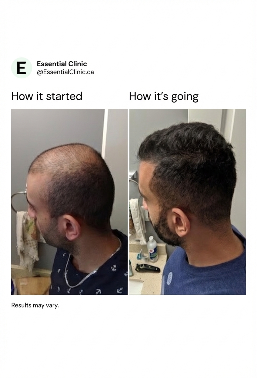 Essential Clinic Canada Facebook ad