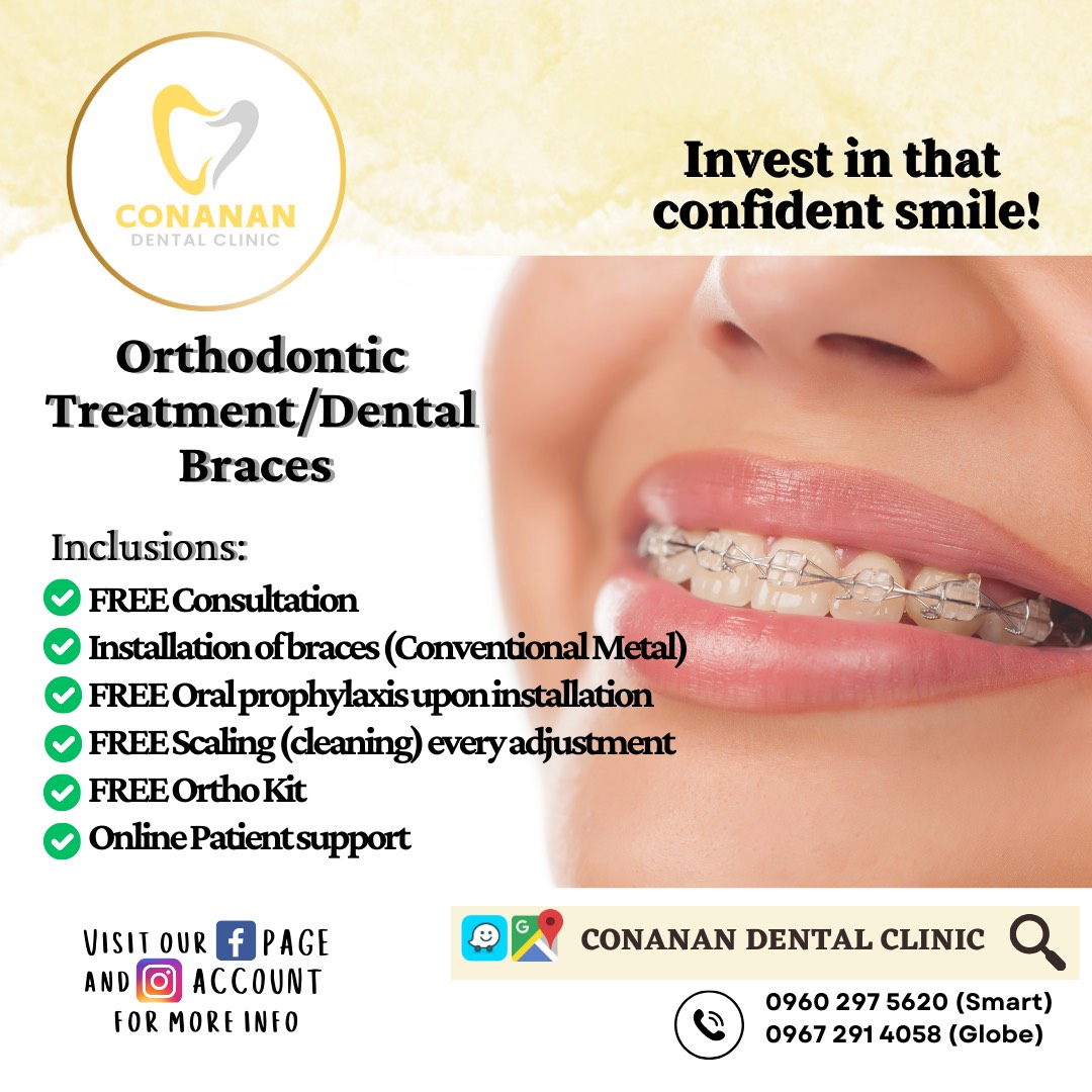 Conanan Dental Clinic Facebook ad