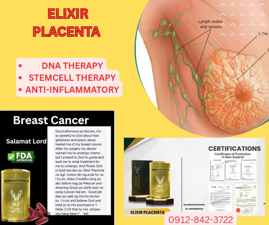 Elixir Placenta Leyte Facebook ad: Ano ang Kanser sa Dibdib?