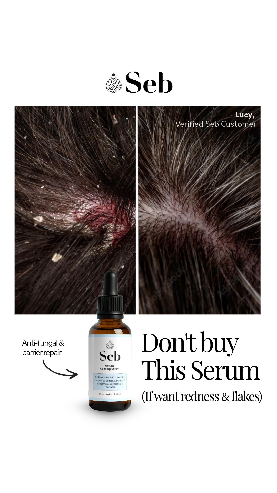 Seb Skincare Facebook ad