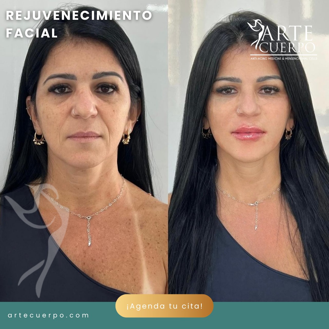 Clinica spa arte cuerpo  Facebook ad