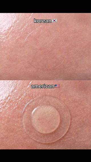 Dr.Melaxin US.official Facebook ad: [DR.MELAXIN] Post-Blemish Marks Still There?