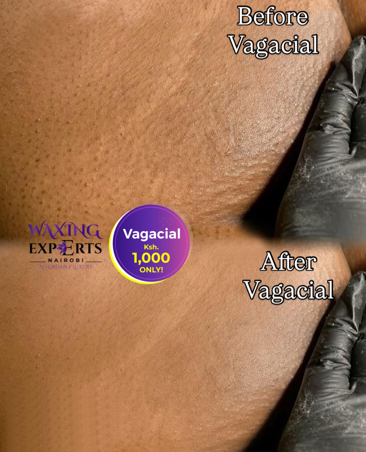 Waxing Experts Nairobi Facebook ad: Why a Vagacial After Waxing?