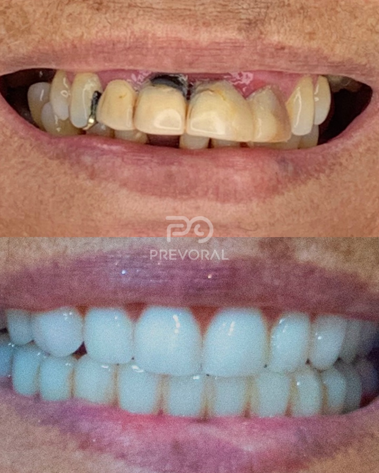 Prev Oral Odontologia Facebook ad: Voltar a sorrir, mastigar e falar com segurança…