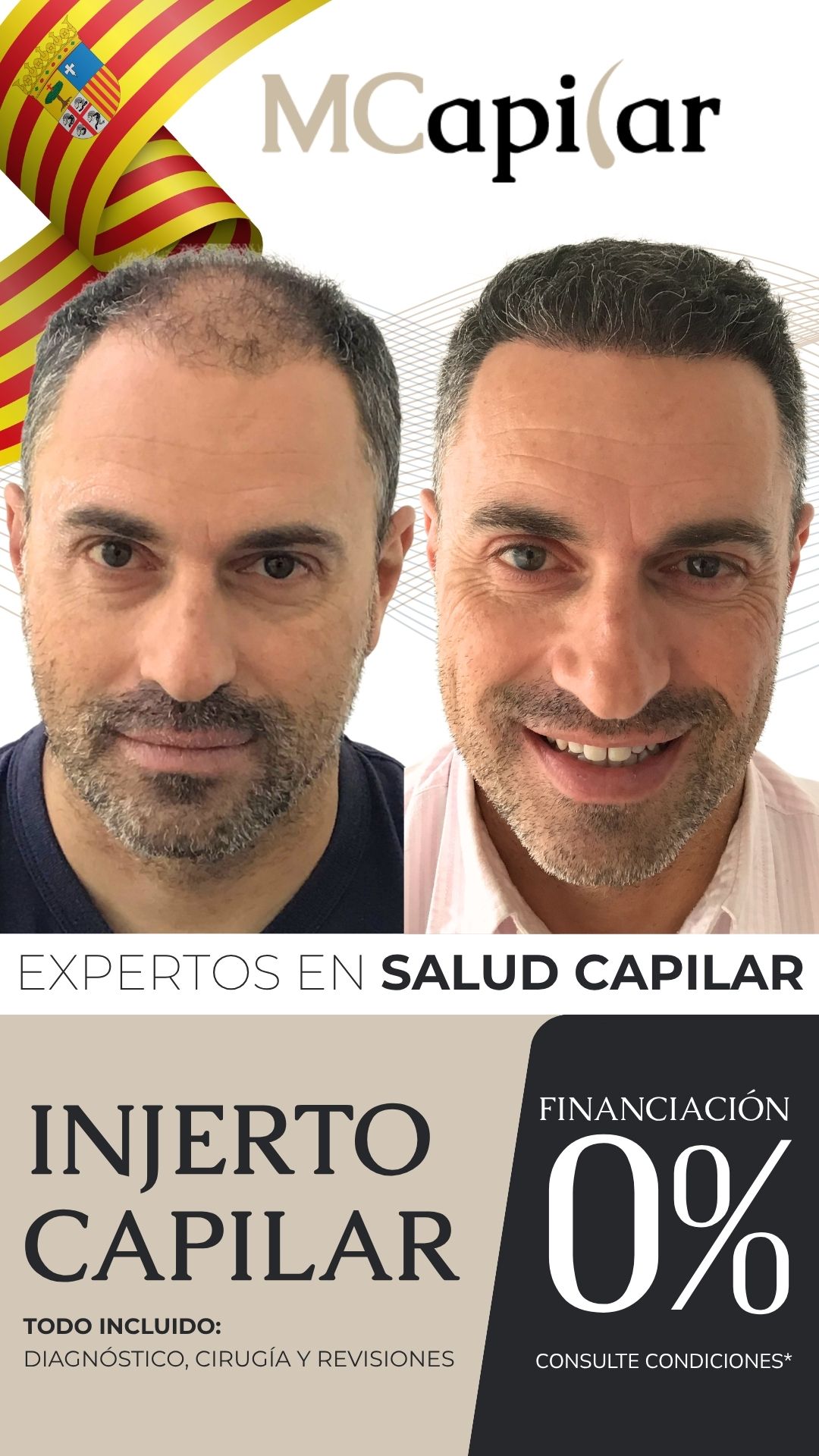 MCapilar Facebook ad