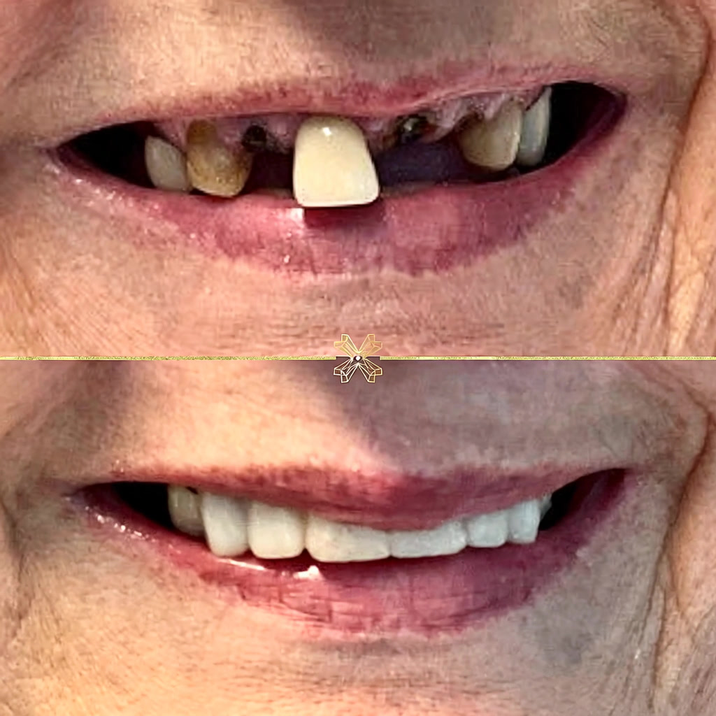 The Lytham Dental Clinic Facebook ad: New Year Implant Deal!