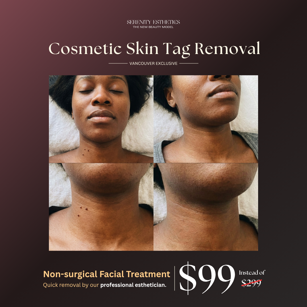 Serenity Spa & Facials Vancouver Facebook ad from Jul 13, 2026