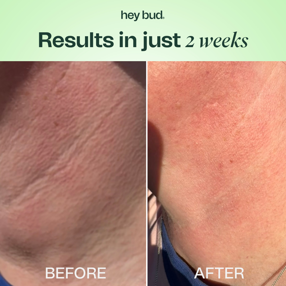 Hey Bud Skincare Facebook ad