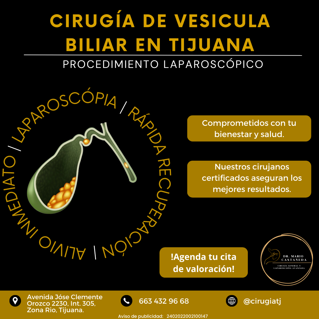 Dr. Mario Castañeda Facebook ad: Cirugía de vesícula biliar en Tijuana