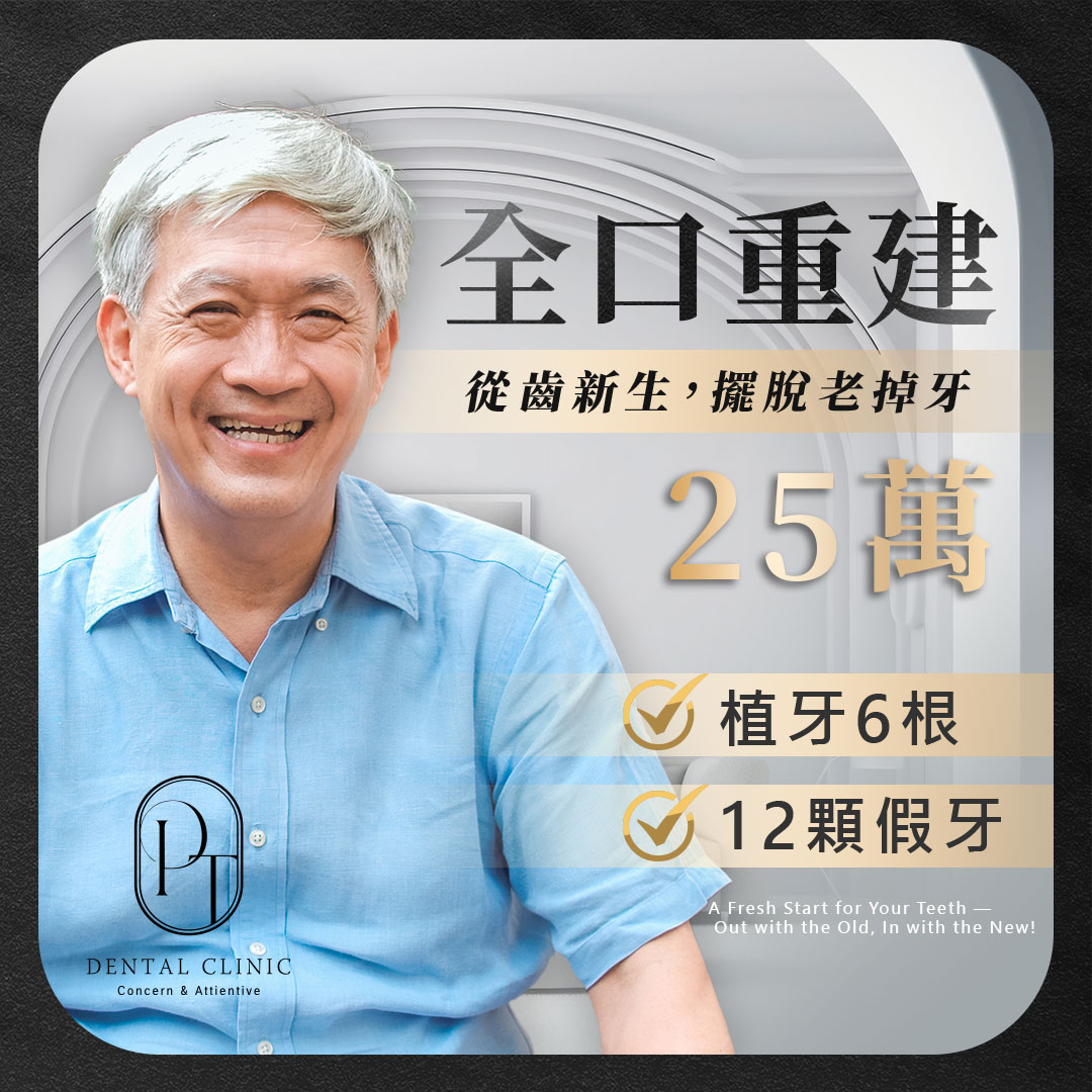 星玥牙醫診所 Facebook ad: All-on-4含整排假牙30萬
