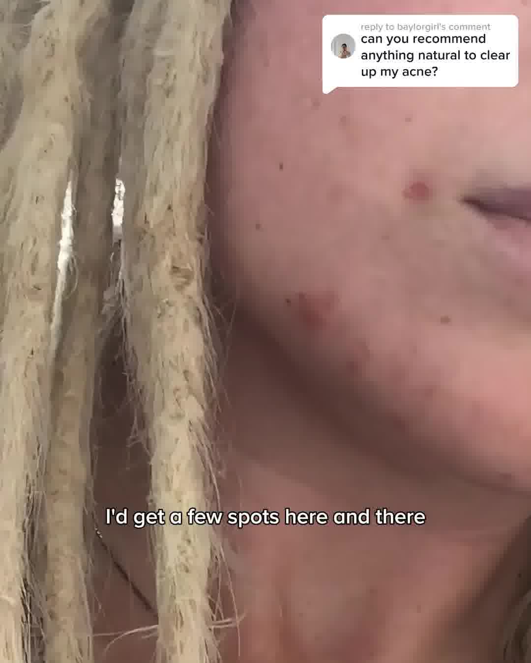 Hey Bud Skincare Facebook ad: Get That Clear Skin Back