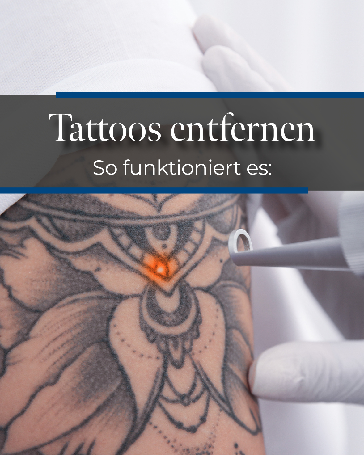 Skinmed AG Facebook ad: Dein Tattoo gefällt dir nicht mehr?