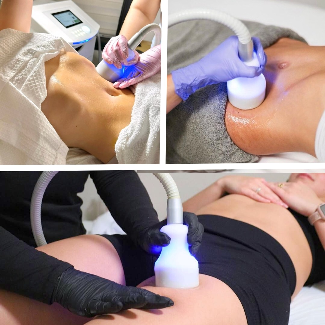 Studio Stiles Facebook ad: Summer Slimdown Special NOW $249