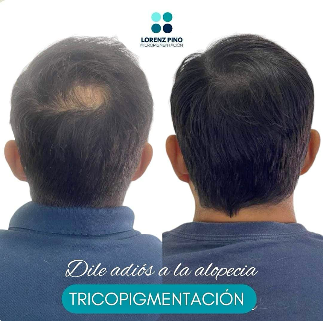 Lorenz Pino Facebook ad: Trico