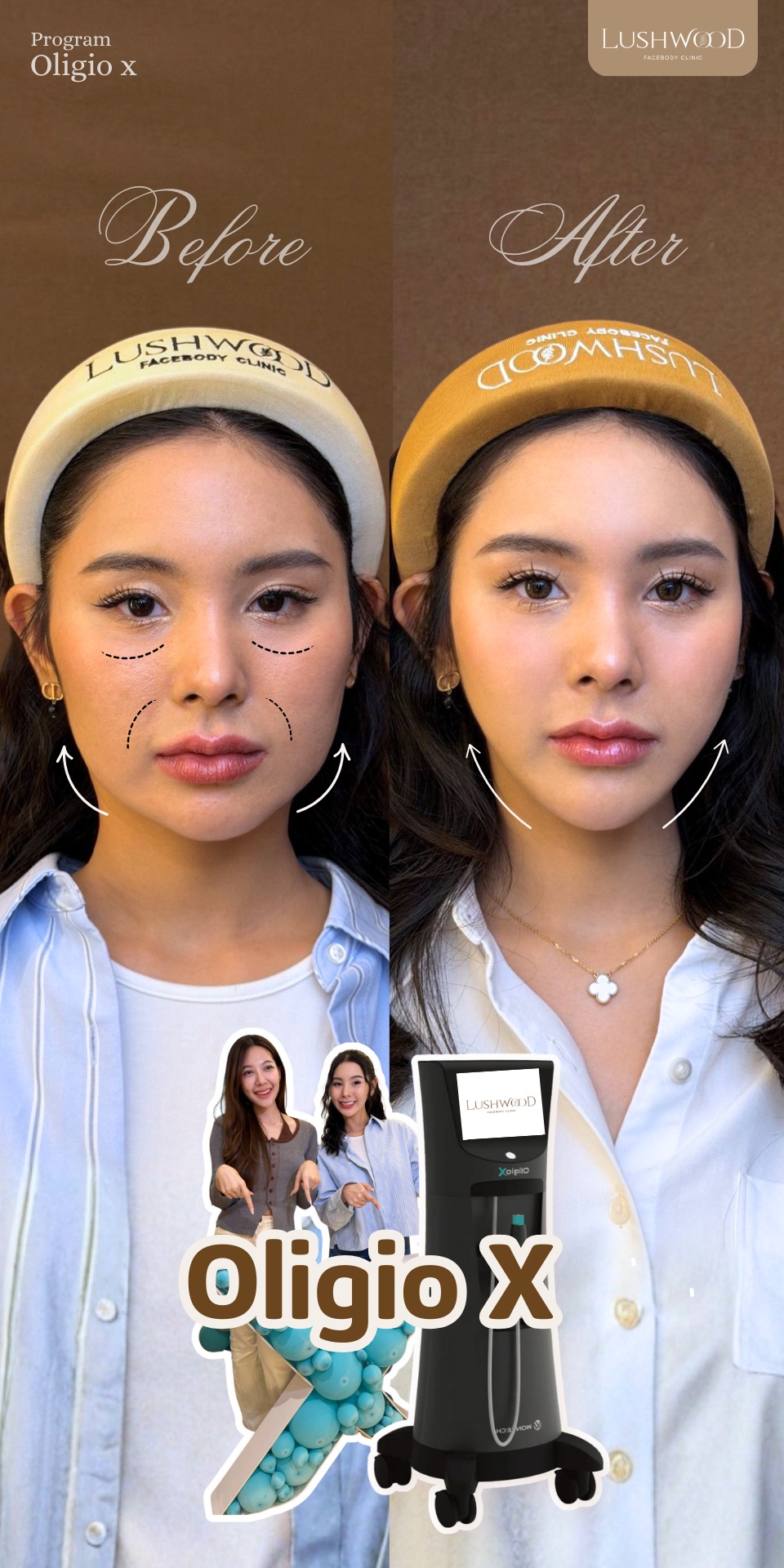 Lushwood Clinic Phuket คลินิกความงาม ลดสัดส่วน ปรับรูปหน้า ภูเก็ต Facebook ad