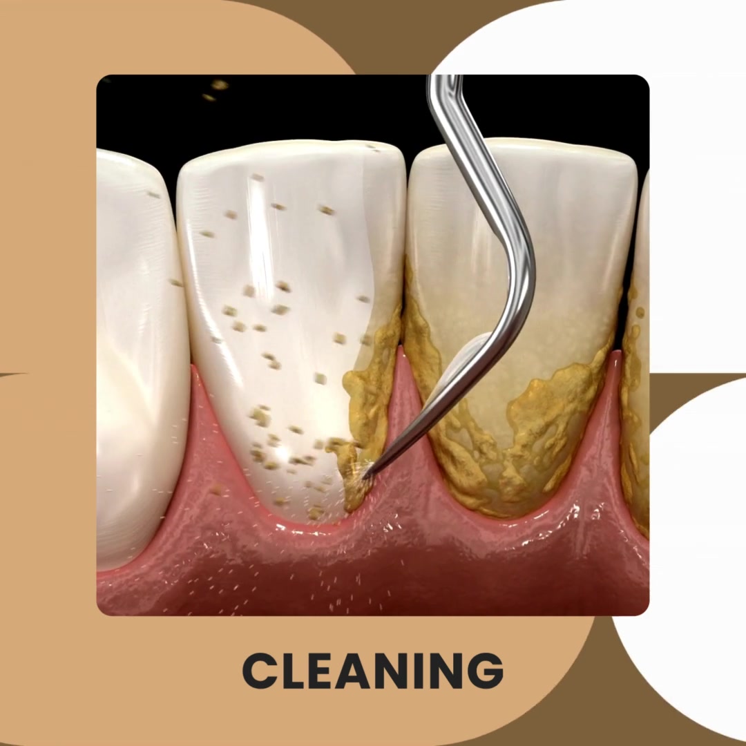 SmileVibe Dental Facebook ad: General & Cosmetic Dentistry | Zionsville