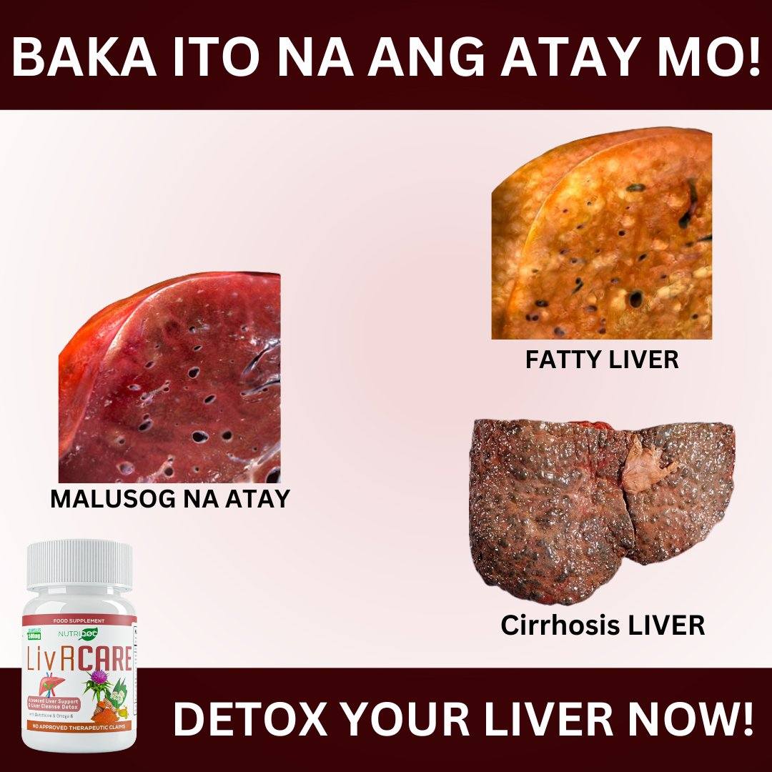 Liver Care All Organic Capsule Facebook ad: WAG MUNA HINTAYIN NA MAGING GANITO ANG ATAY…