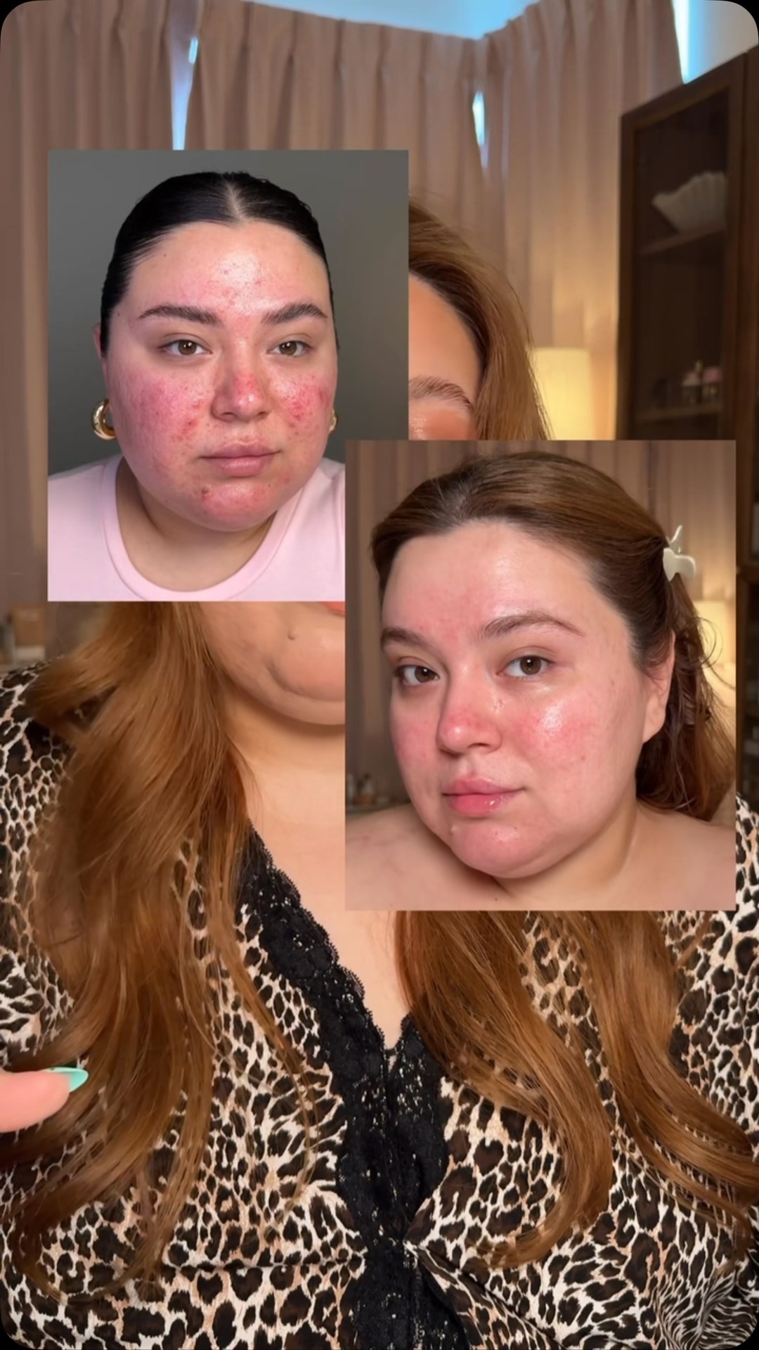The Ordinary Facebook ad: trust me, give this one a try, your…