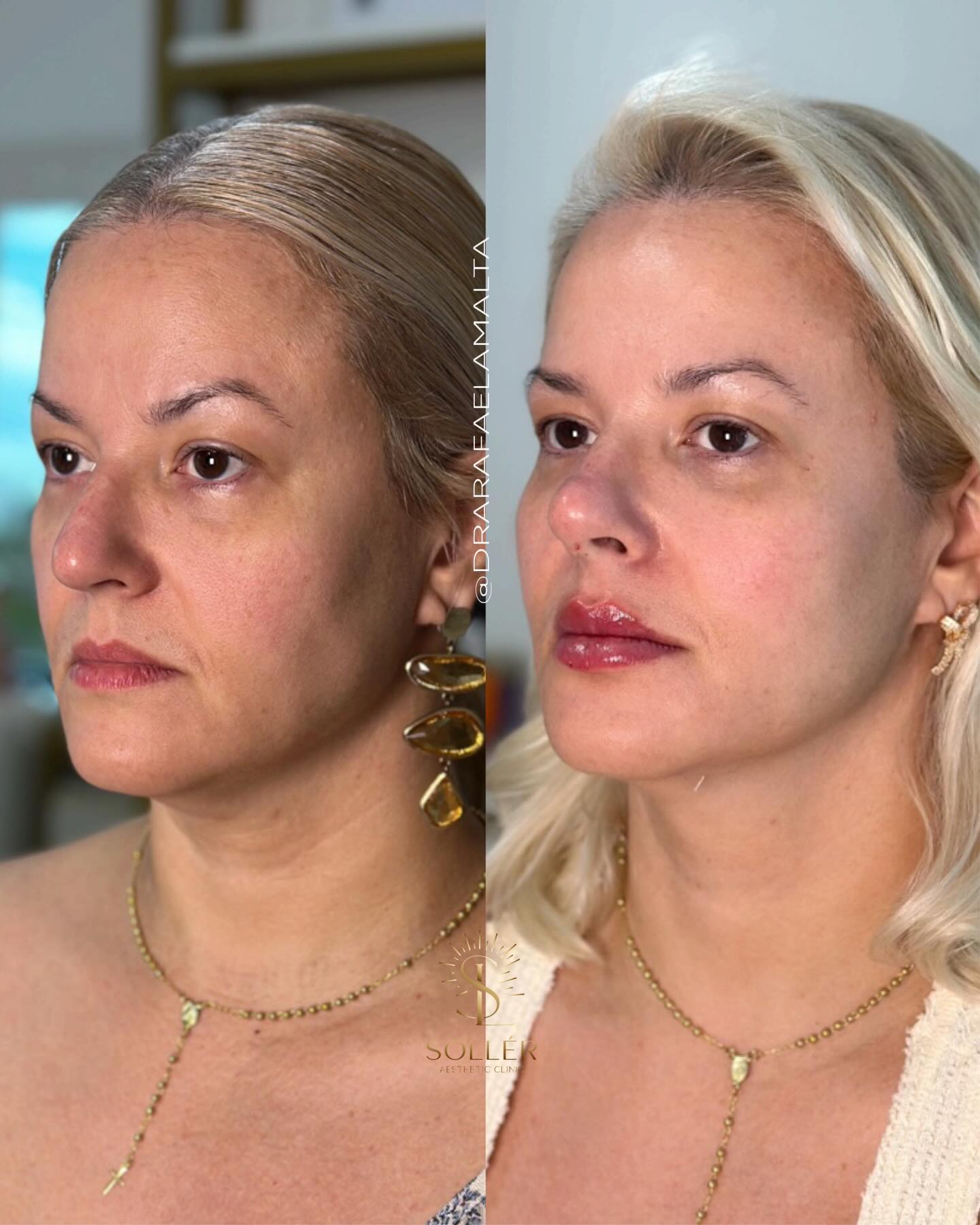 drarafaelamalta Facebook ad: O que antes eram pequenos incômodos quando a…