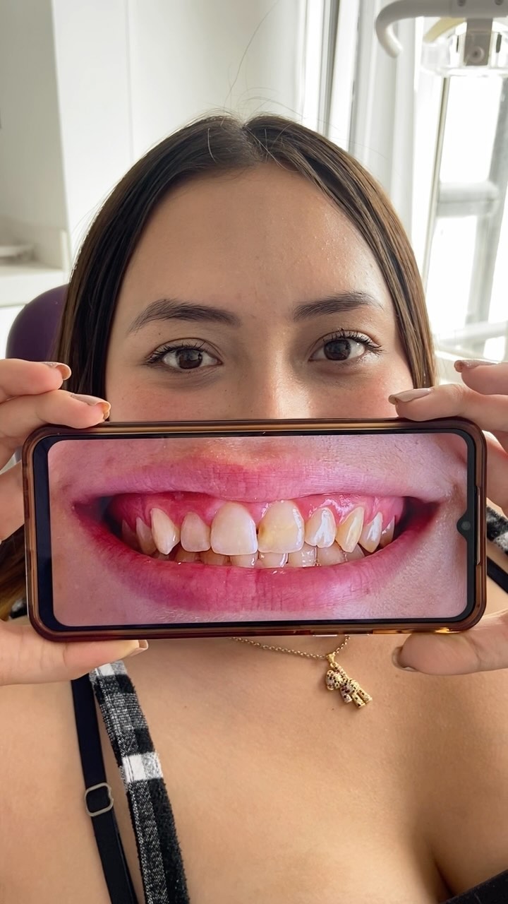 Odontóloga Ana María Lagos Facebook ad: ¡La sonrisa que todos quieren!