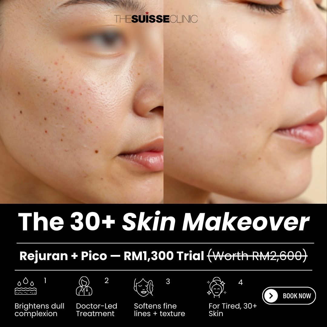 The Suisse Clinic Facebook ad: Tired of dull, tired-looking skin? The 30+ Skin Makeover…