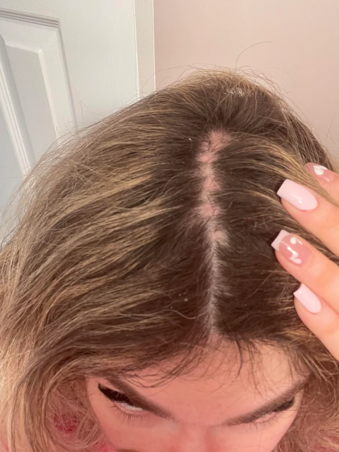 Hair Solutions Facebook ad