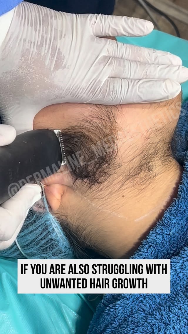 dermaline_medaesthetics Facebook ad from Apr 6, 2026