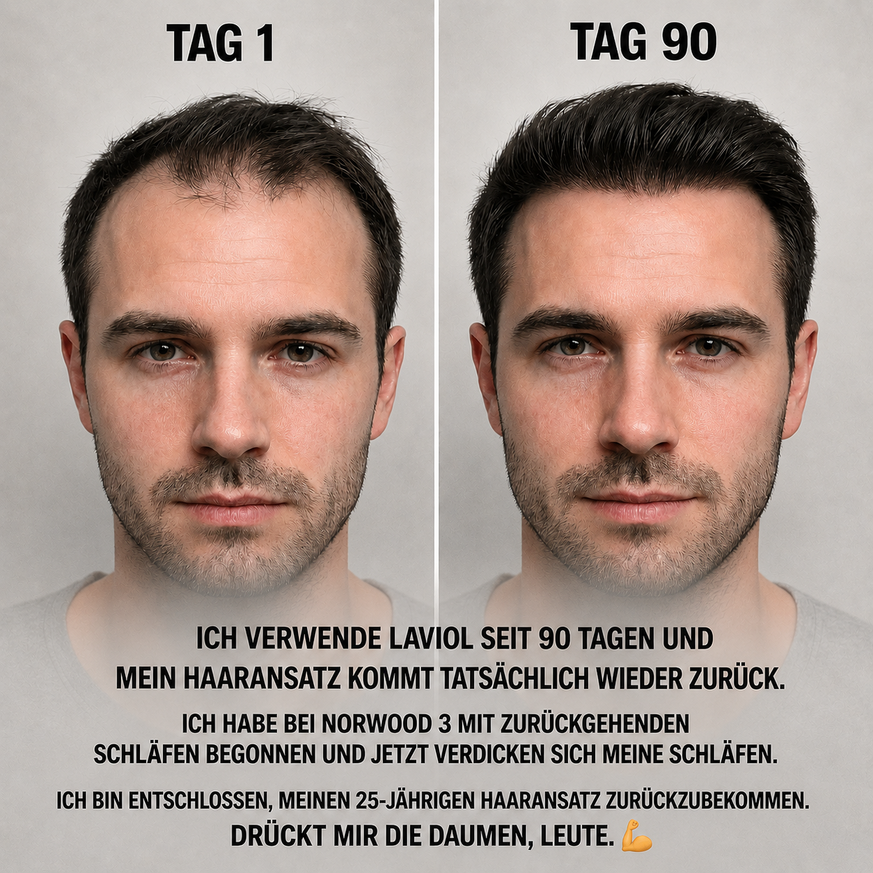 Lameo Facebook ad: Das Serum, das jede andere Lösung gegen Haarausfall ersetzt.