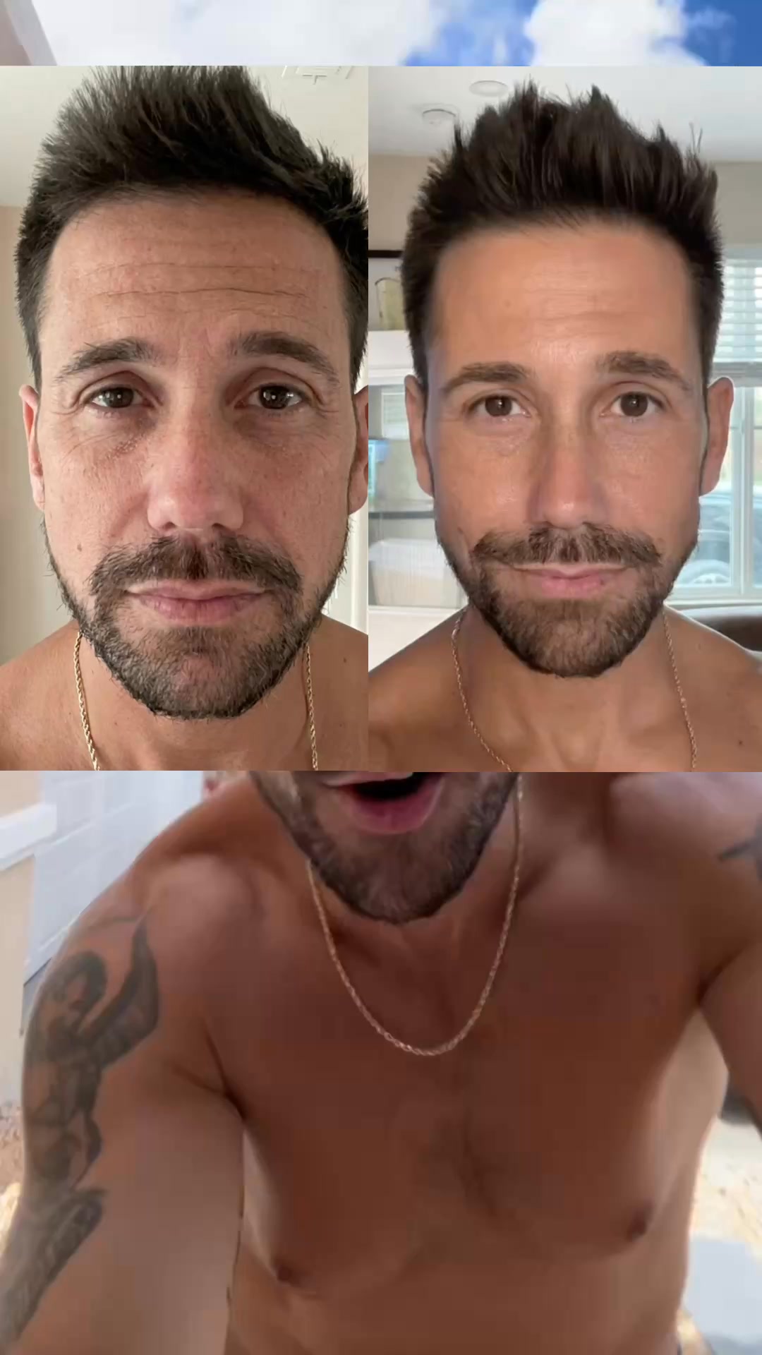 Bare Ritual Facebook ad: No Botox. Just this.