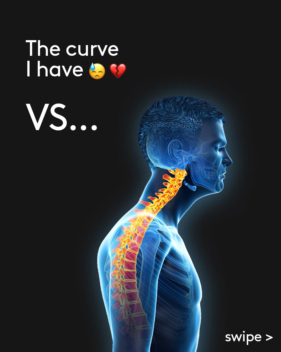 Logitech Facebook ad: Let’s be honest: your shrimp posture isn’t doing…