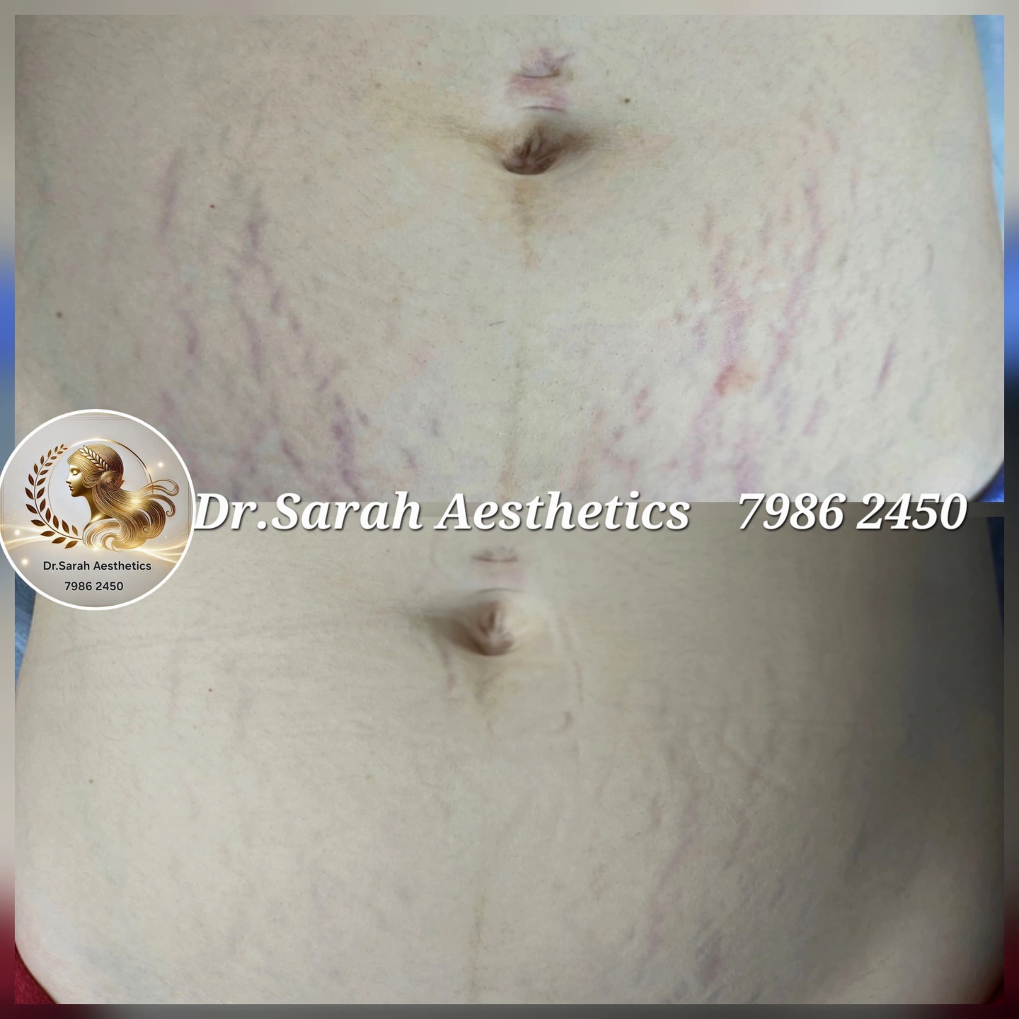 Dr.Sarah Aesthetics Facebook ad